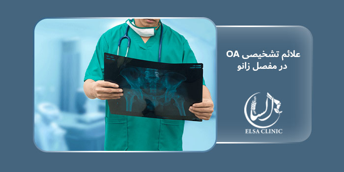 علائم تشخیصی OA در مفصل زانو
