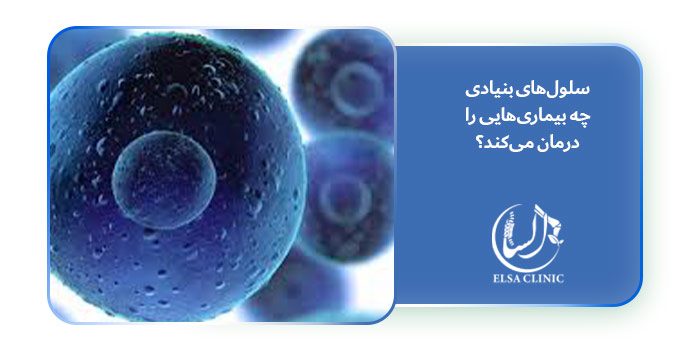 سلول‌های بنیادی چه بیماری‌هایی را درمان می‌کند؟
