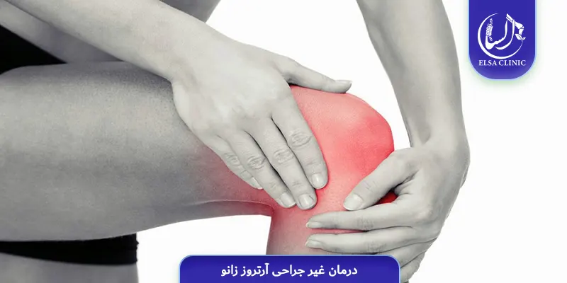 درمان غیر جراحی آرتروز زانو