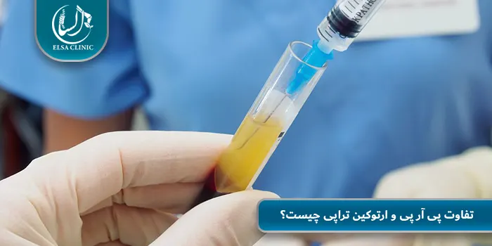 تفاوت پی آر پی و ارتوکین تراپی چیست؟