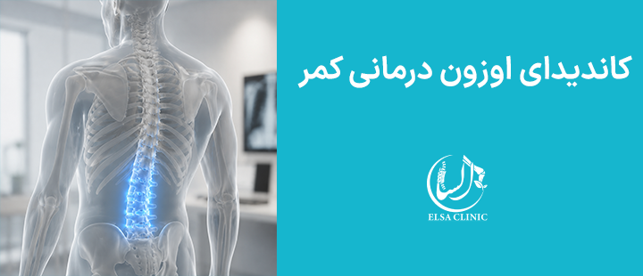 کاندیدای مناسب اوزون درمانی کمر 