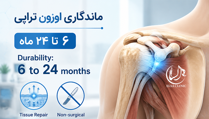 ماندگاری  اوزون تراپی شانه